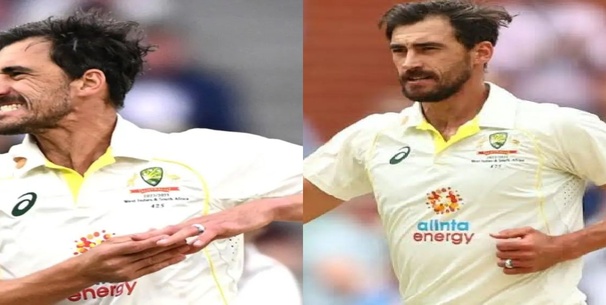 Mitchell Starc Injury