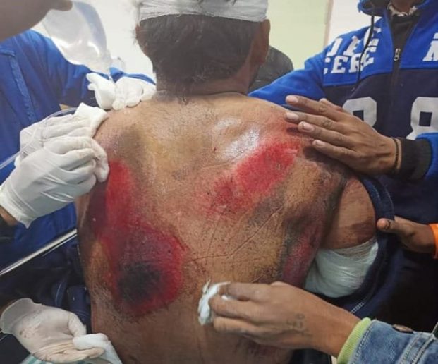 Rishabh Pant Injury